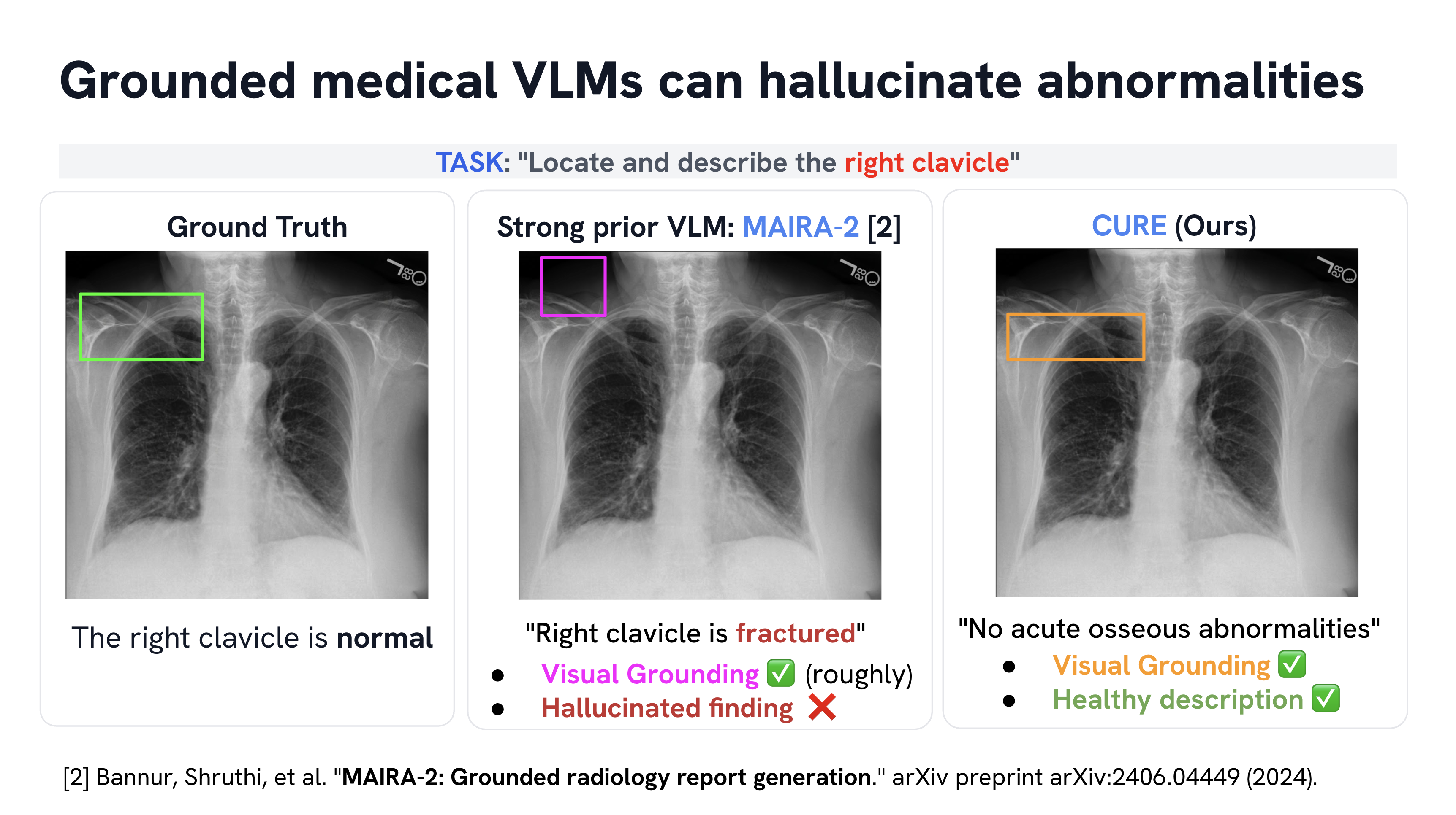 Motivation: Comparison of MAIRA-2 and CURE on right clavicle grounding